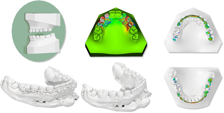 maestro3d.dental.studio.measurements.tools.jpg
